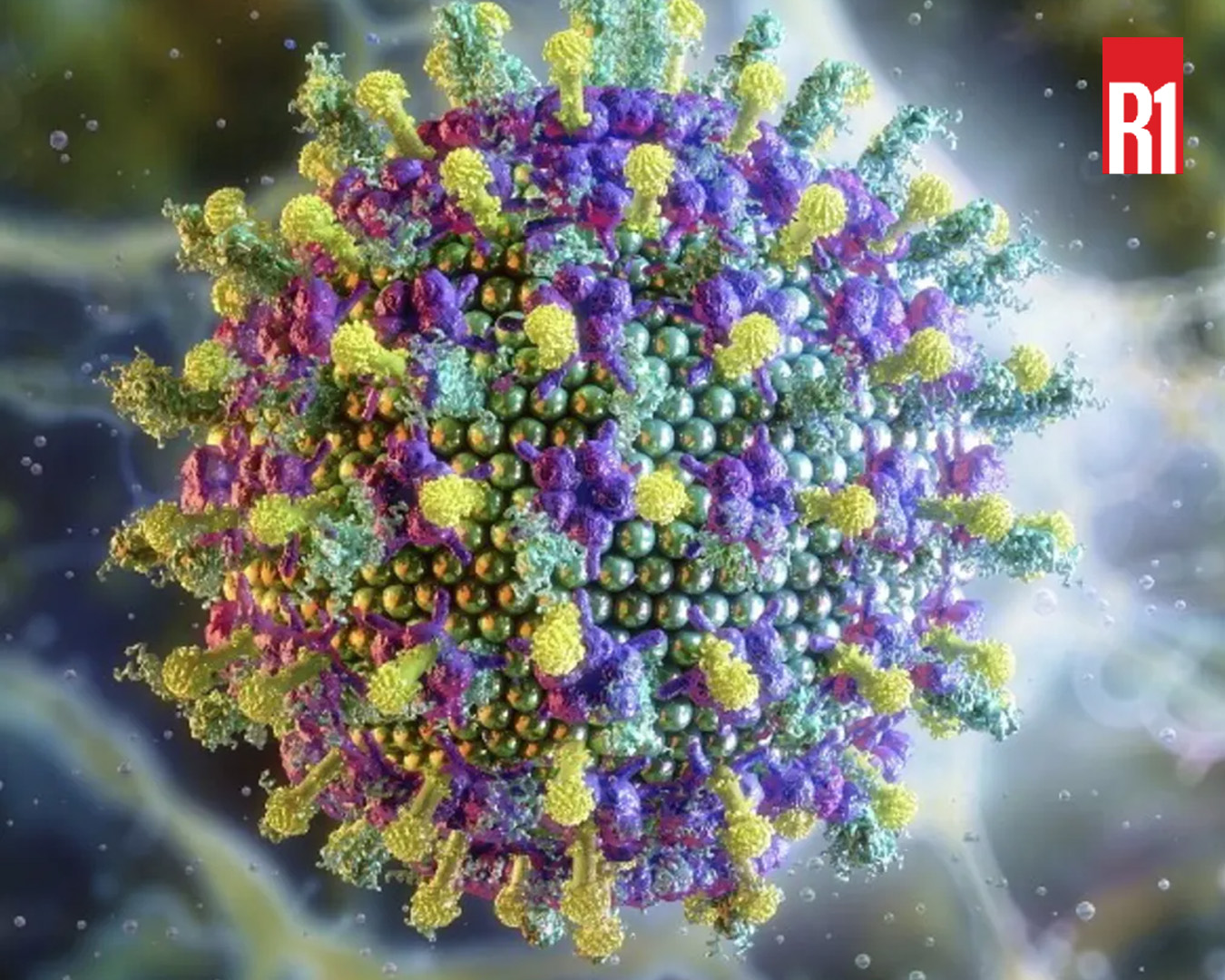 Virus Nipah